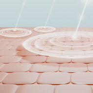 복합시술 프로토콜